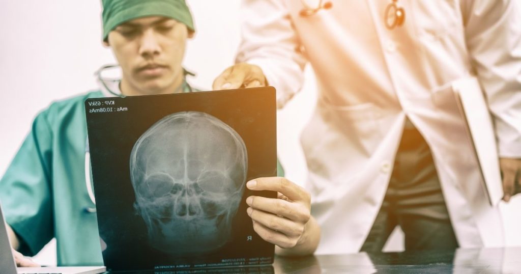 Car Accident Brain Injury